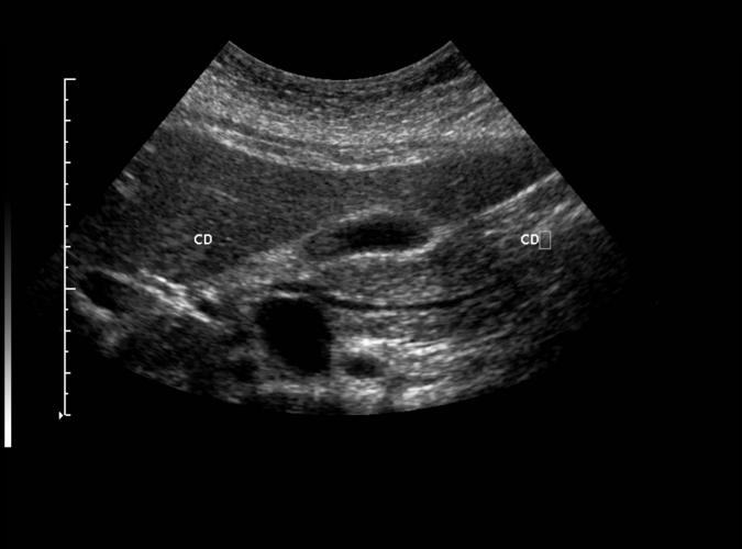 1m av  Catherine Olsson, sonograf